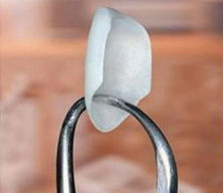 The tip of dental forceps hold a porcelain veneer