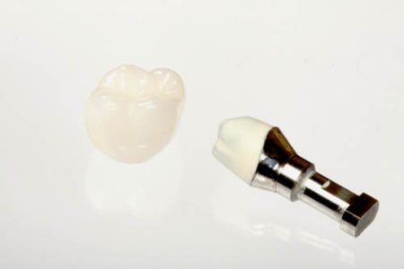 Dental implant complete with a crown and an unattached crown to the left of it