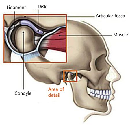 Diagram of skull side-view with the TMJ area detailed and an enlarged view of the joint, ligament, disk, and condyle